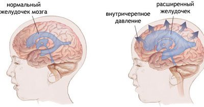 Як визначити що дитину нудить. Блювота при прорізуванні зубів у дітей. Нудота: ефективні медикаментозні засоби для 